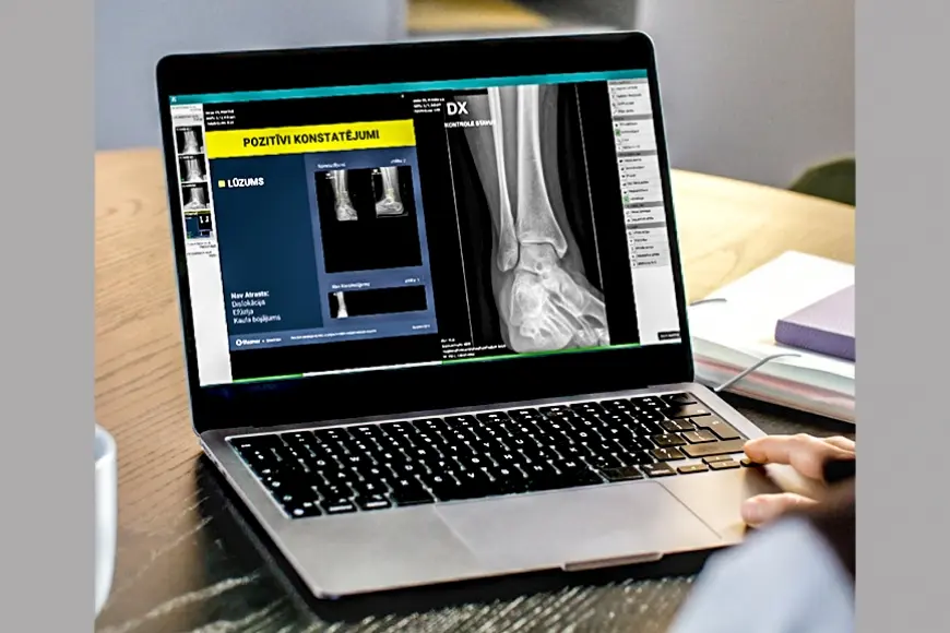 Kurzeme: Rentgena diagnostikā izmanto mākslīgo intelektu